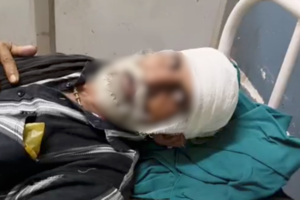 banda bhabhua axe attack