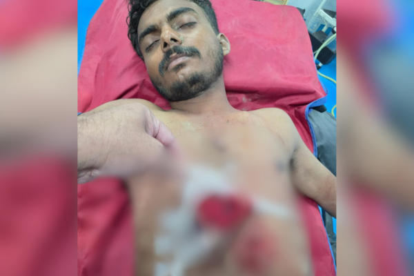 gorakhpur doctors save youth