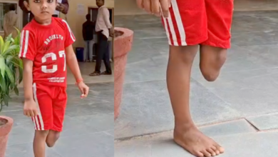 banda girls leg amputated