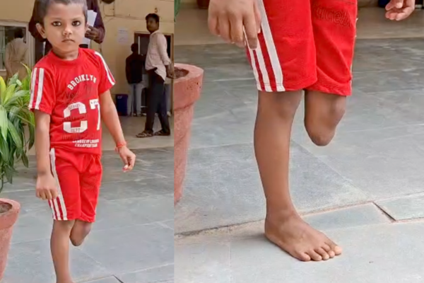 banda girls leg amputated